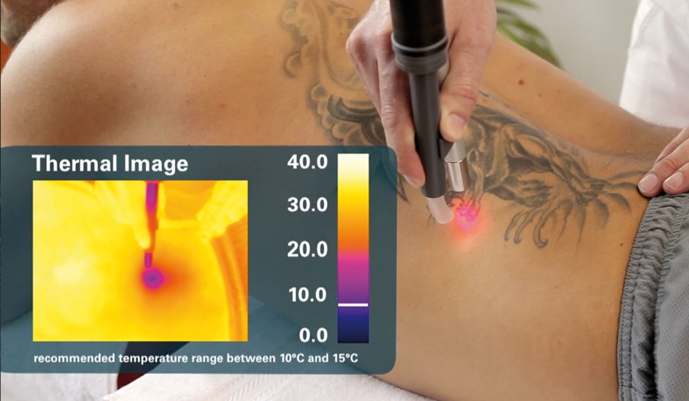 Cryo 7 Cold Air Chiller Zimmer Laser Pain Relief