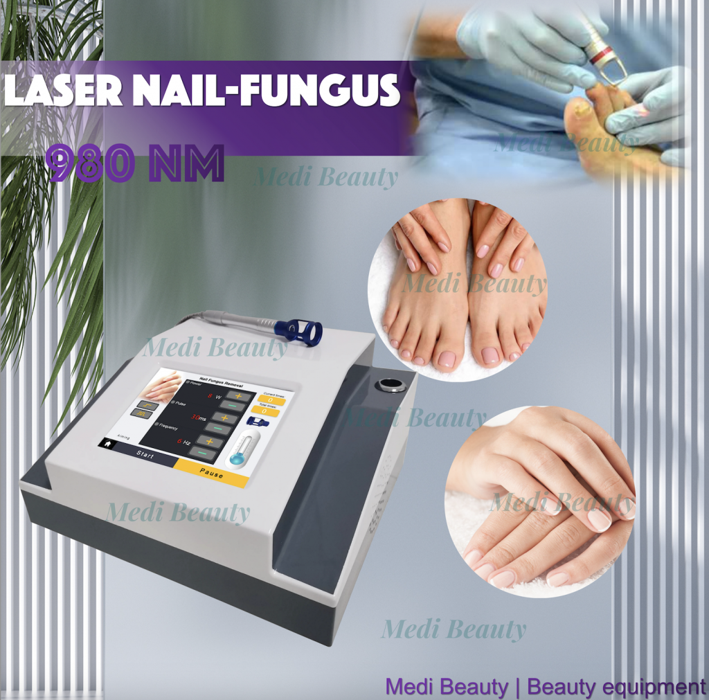980nm Diode Laser Nail Fungus Removal