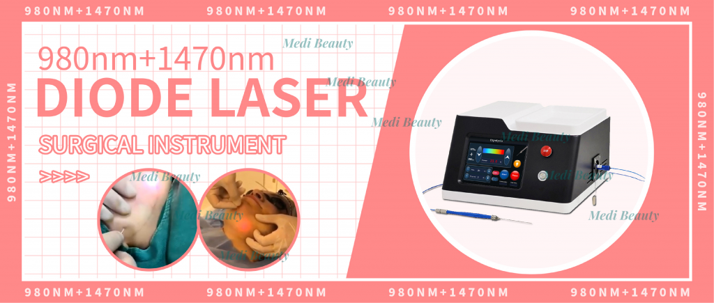 980 1470 635 Endo lipo Face Lift 