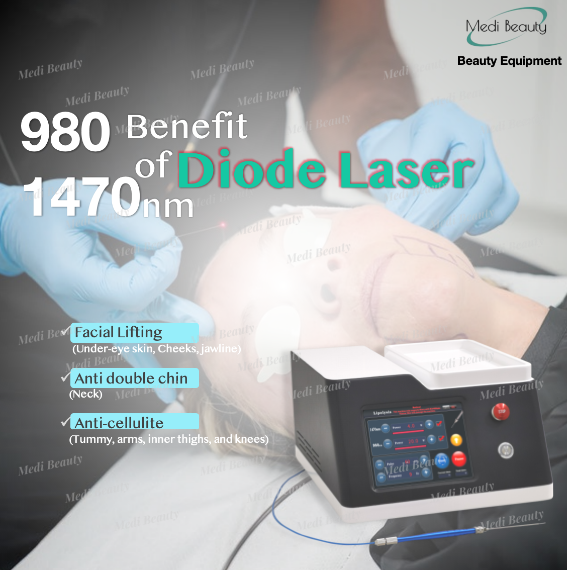 980 1470LaserMD