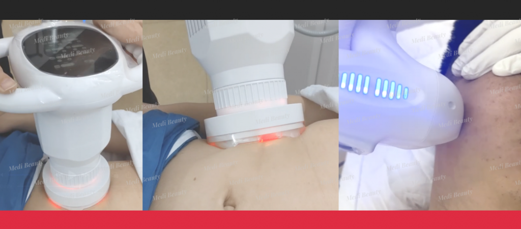Massage 360 Rotation RF Vera Roller